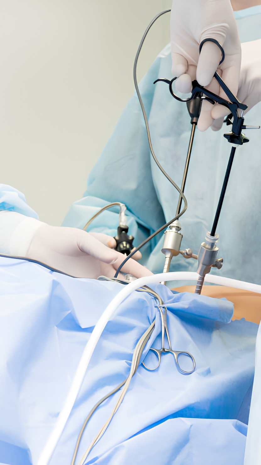 Ovarian cyst surgery laparoscopic fertility treatment at AnuSri Hospitals Secunderabad Hyderabad